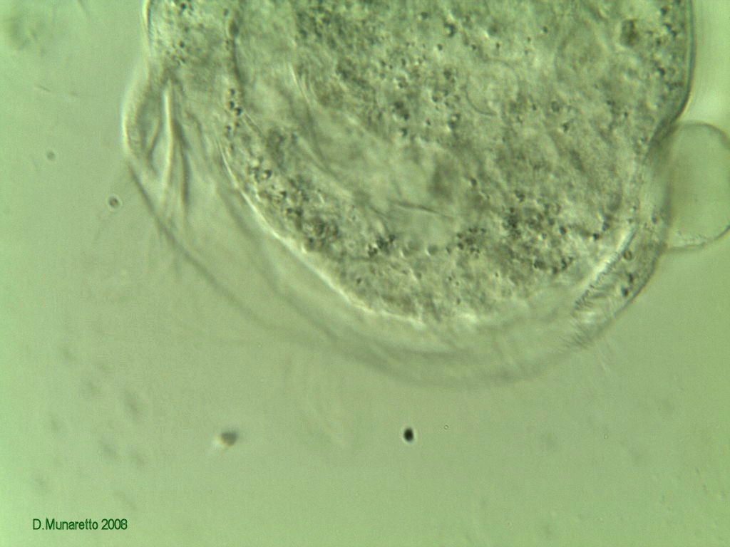 Rieccomi...con Vorticella Gigante a 630x !